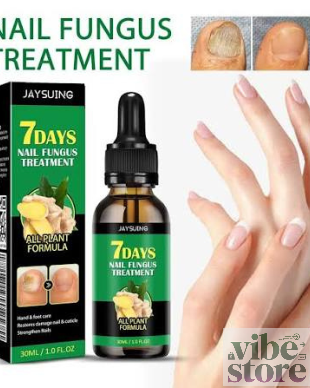 7 Days Nail Tratamiento Para Hongos
